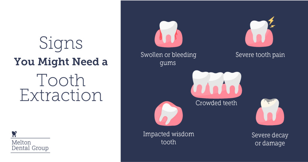 signs-you-need-a-tooth-extraction